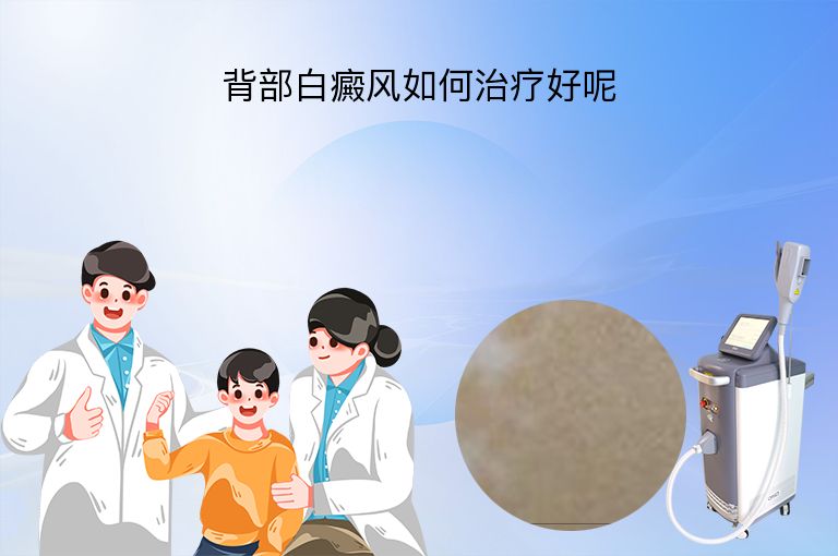 背部白癜风如何治疗好呢”
