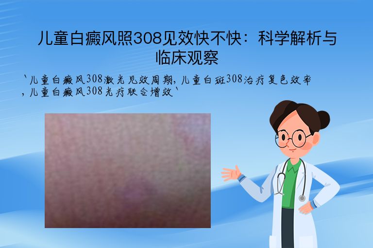 儿童白癜风照308见效快不快:科学解析与临床观察