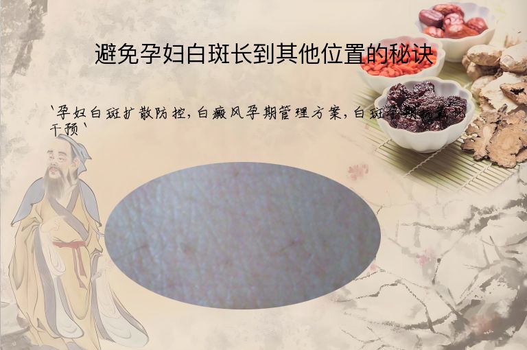 避免孕妇白斑长到其他位置的秘诀