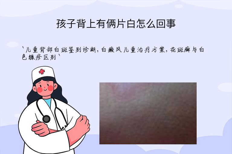 孩子背上有俩片白怎么回事