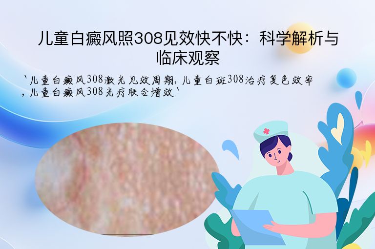 儿童白癜风照308见效快不快:科学解析与临床观察