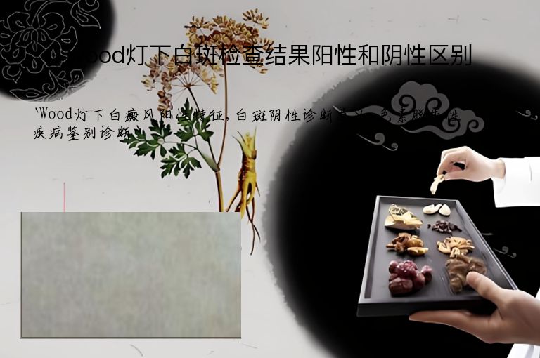 wood灯下白斑检查结果阳性和阴性区别”