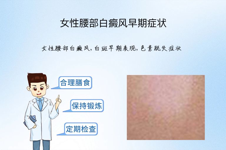 女性腰部白癜风早期症状”