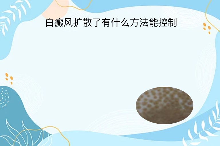 https://www.bdfsjzyy.com/d/file/p/03096eb2a303e9f10bd8343ff2c0034e.jpeg