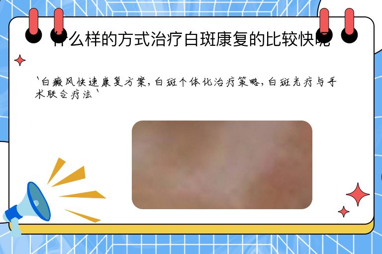 什么样的方式治疗白斑康复的比较快呢