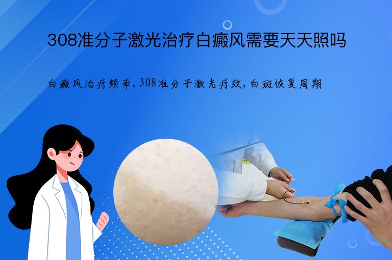 308准分子激光治疗白癜风需要天天照吗”
