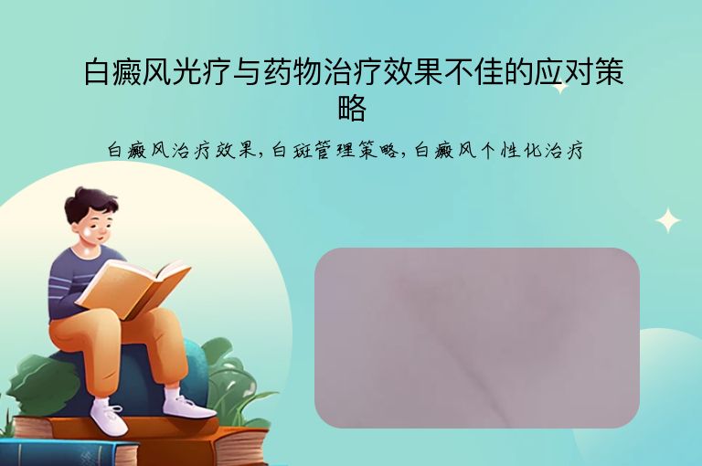 白癜风光疗与药物治疗效果不佳的应对策略”