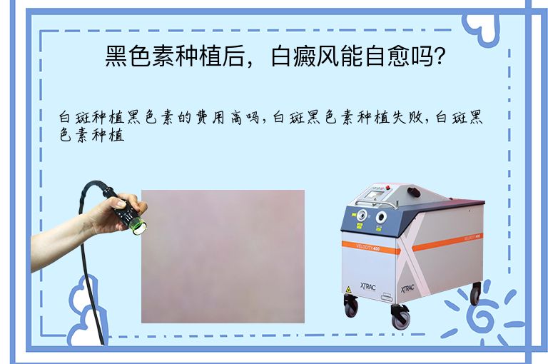 https://www.bdfsjzyy.com/d/file/p/fcbfa651a1b905894ae338e1752ef6a9.jpeg