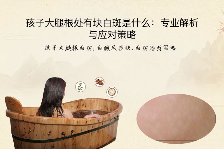 孩子大腿根处有块白斑是什么:专业解析与应对策略”