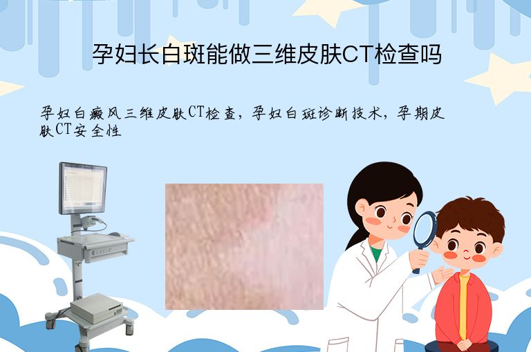 孕妇长白斑能做三维皮肤CT检查吗”
