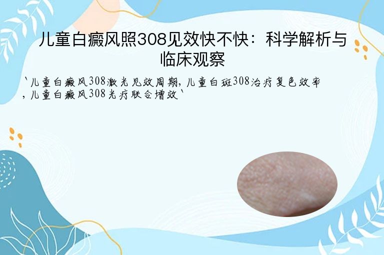 儿童白癜风照308见效快不快：科学解析与临床观察