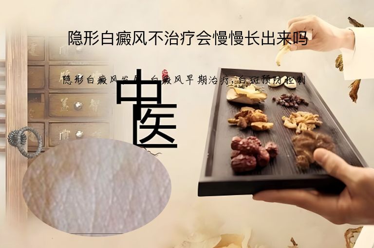 隐形白癜风不治疗会慢慢长出来吗”