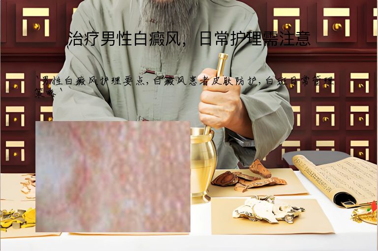 治疗男性白癜风,日常护理需注意