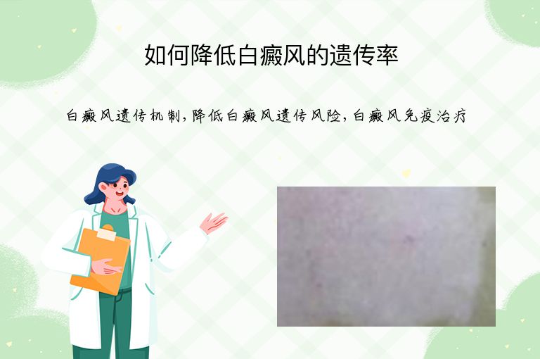 如何降低白癜风的遗传率”