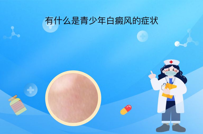 有什么是青少年白癜风的症状