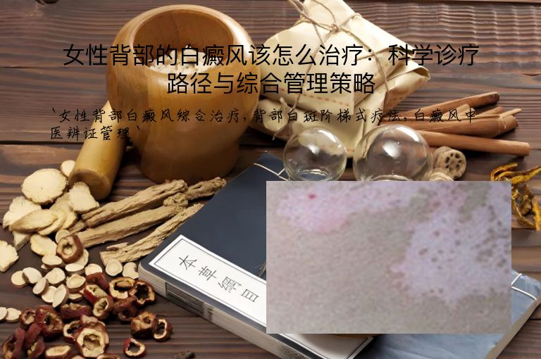 女性背部的白癜风该怎么治疗:科学诊疗路径与综合管理策略