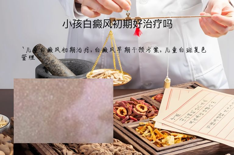 小孩白癜风初期好治疗吗