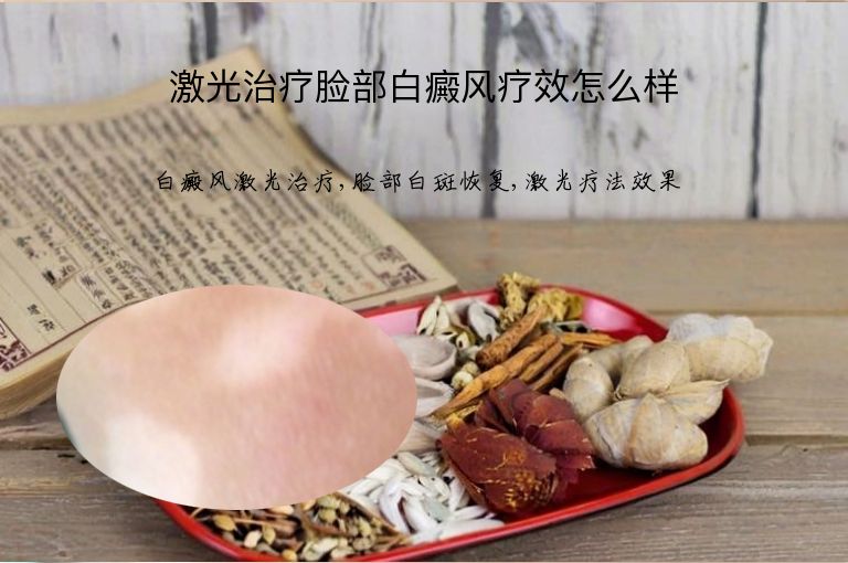激光治疗脸部白癜风疗效怎么样”