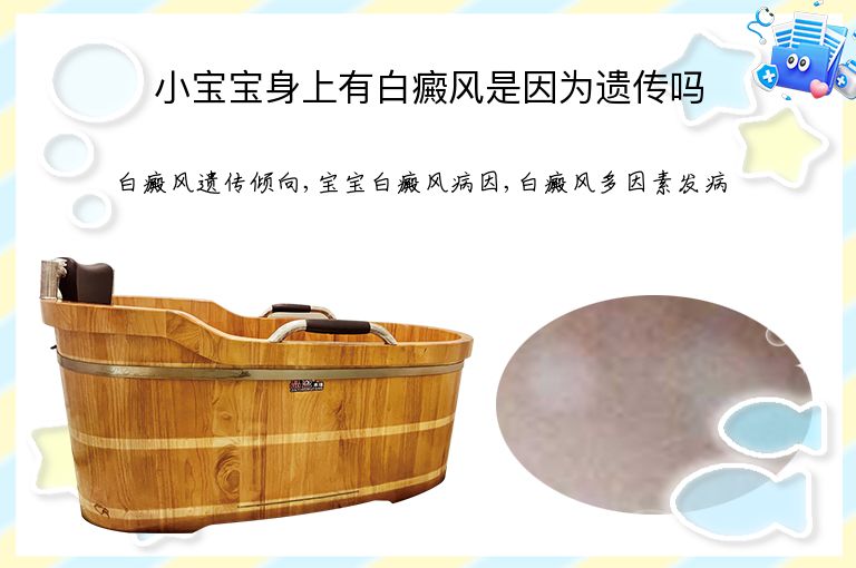 小宝宝身上有白癜风是因为遗传吗”