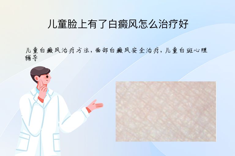 儿童脸上有了白癜风怎么治疗好”