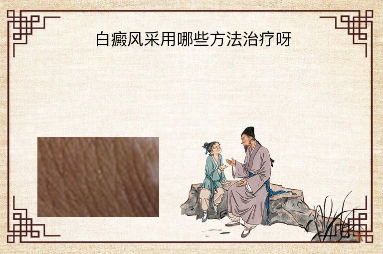 https://www.bdfsjzyy.com/d/file/p/b73e3517747c47af88106f81ef8f9091.jpeg