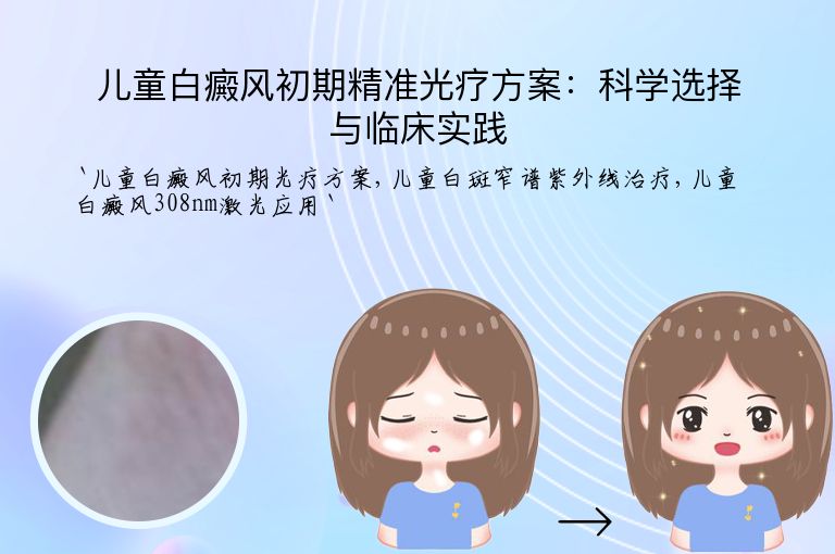 儿童白癜风初期精准光疗方案：科学选择与临床实践