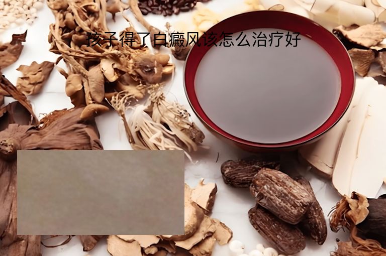 孩子得了白癜风该怎么治疗好”