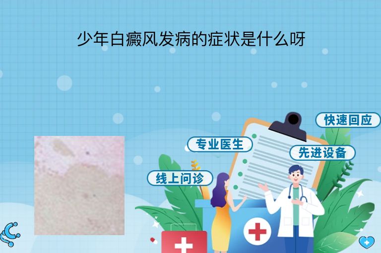 https://www.bdfsjzyy.com/d/file/p/f4cb42b373a1a2ce4ec6f5277a7c0255.jpeg