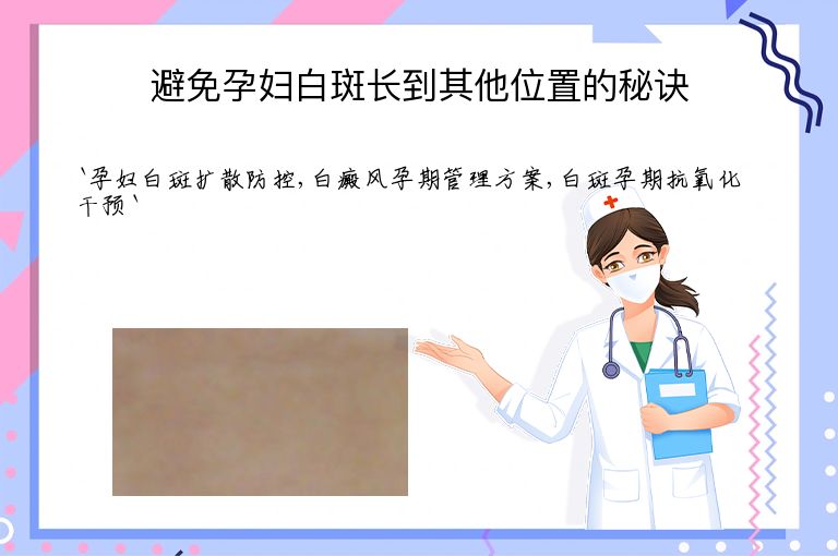 避免孕妇白斑长到其他位置的秘诀