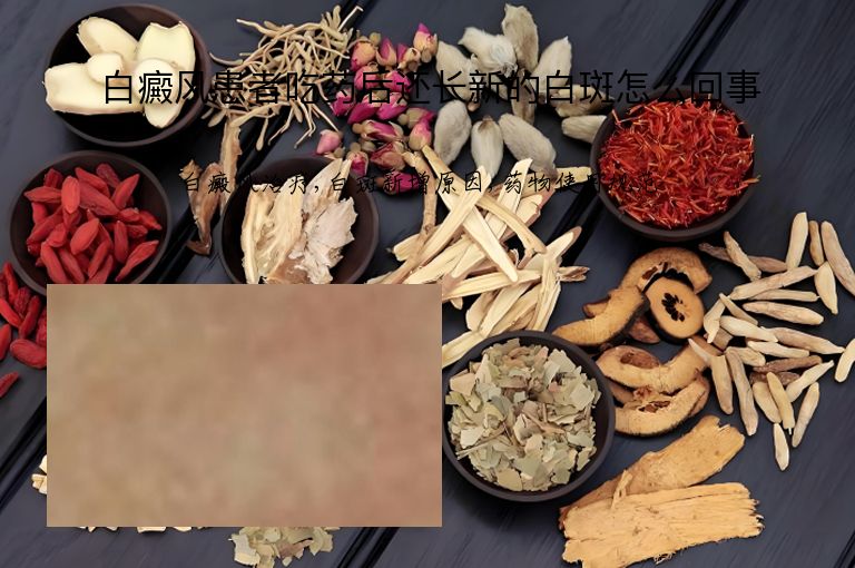 白癜风患者吃药后还长新的白斑怎么回事”