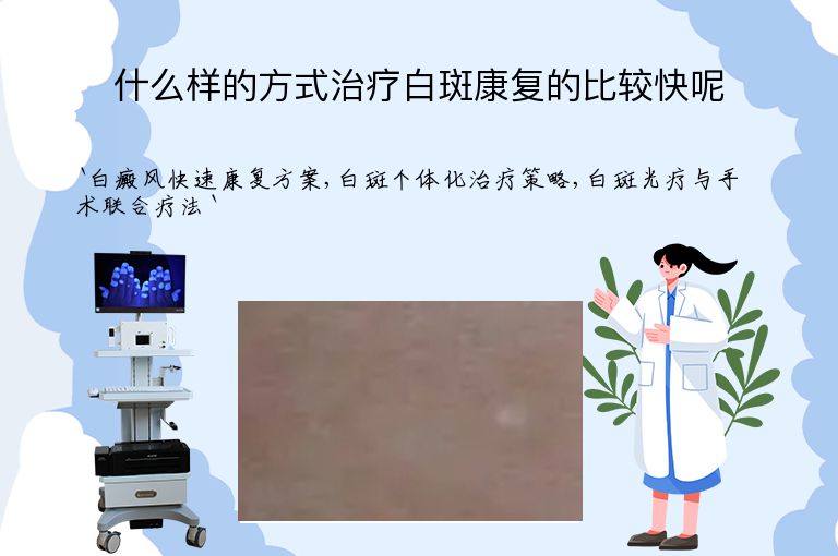 什么样的方式治疗白斑康复的比较快呢