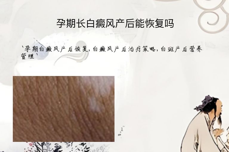 https://www.bdfsjzyy.com/d/file/p/b195b388df31831eacfced4f5e6c64ea.jpeg