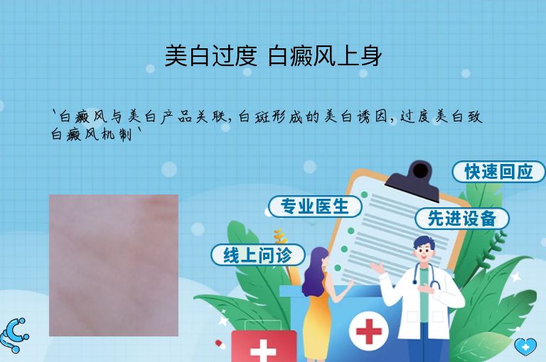 美白过度 白癜风上身”