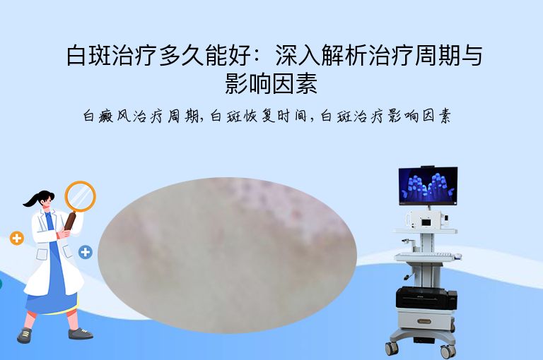 白斑治疗多久能好:深入解析治疗周期与影响因素”
