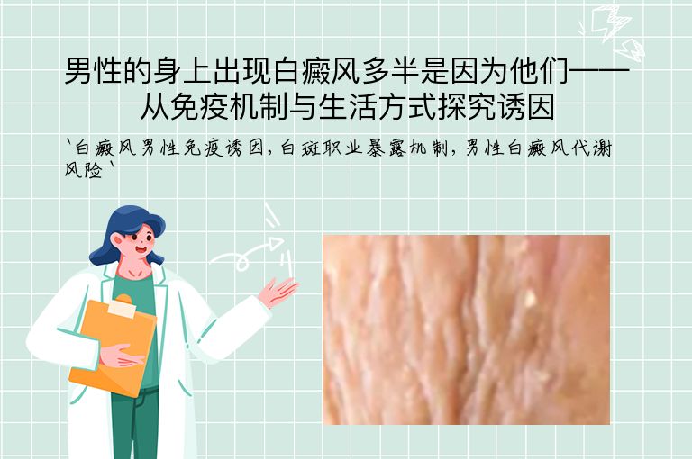 男性的身上出现白癜风多半是因为他们——从免疫机制与生活方式探究诱因