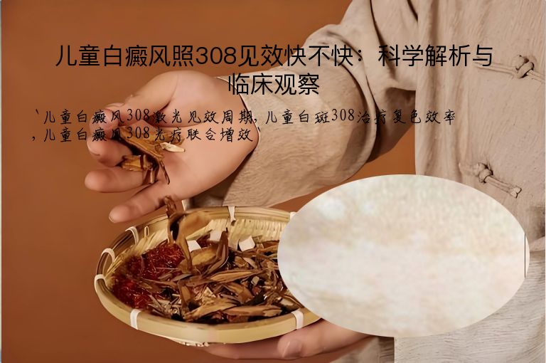 儿童白癜风照308见效快不快:科学解析与临床观察