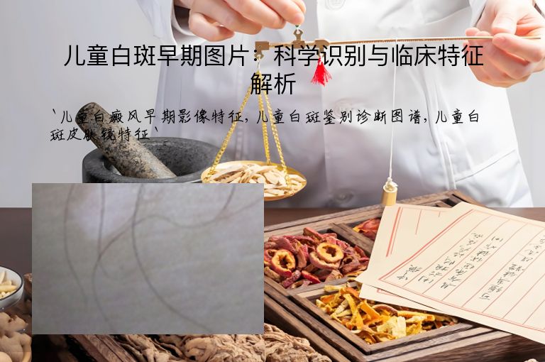 儿童白斑早期图片：科学识别与临床特征解析
