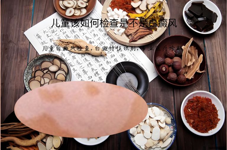 儿童该如何检查是不是白癜风”