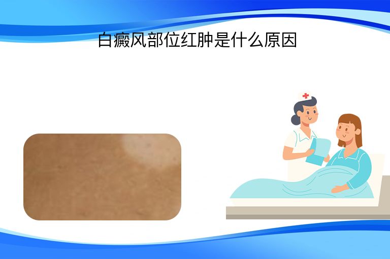 https://www.bdfsjzyy.com/d/file/p/d23e7bed78034db627c535c6125e35f9.jpeg