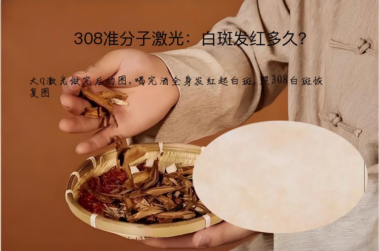 308准分子激光:白斑发红多久?”