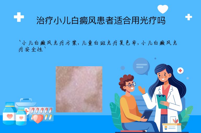 治疗小儿白癜风患者适合用光疗吗