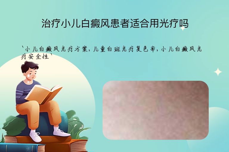 治疗小儿白癜风患者适合用光疗吗