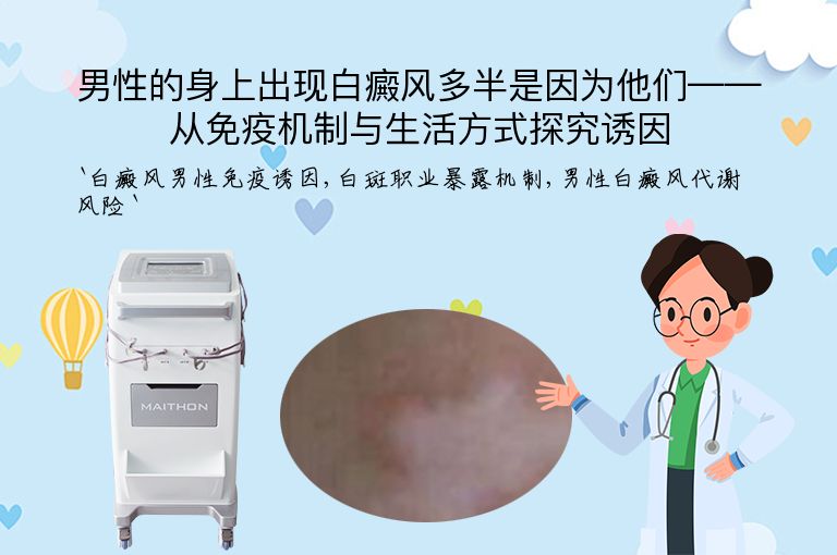男性的身上出现白癜风多半是因为他们——从免疫机制与生活方式探究诱因