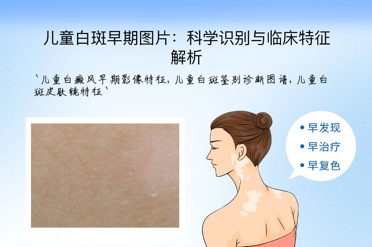 儿童白斑早期图片:科学识别与临床特征解析