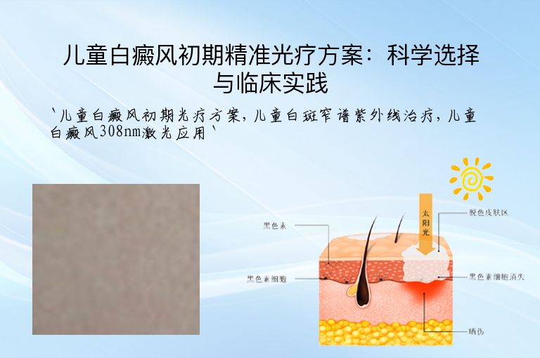 儿童白癜风初期精准光疗方案:科学选择与临床实践