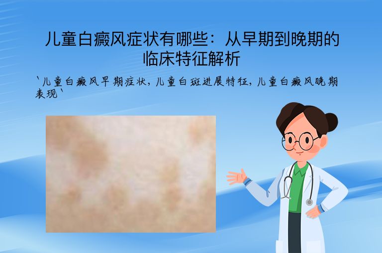 儿童白癜风症状有哪些:从早期到晚期的临床特征解析