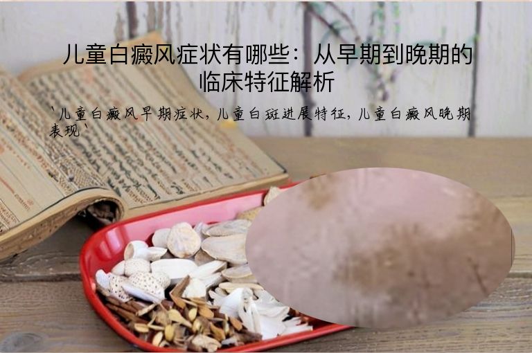 儿童白癜风症状有哪些：从早期到晚期的临床特征解析