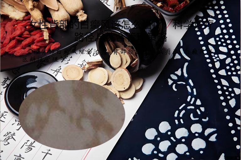 女性背部的白癜风该怎么治疗：科学诊疗路径与综合管理策略