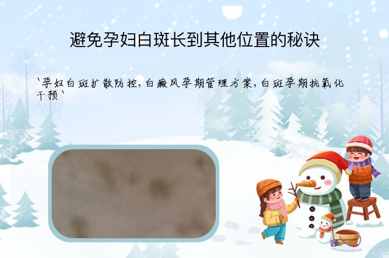 避免孕妇白斑长到其他位置的秘诀