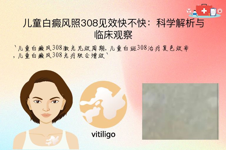 儿童白癜风照308见效快不快:科学解析与临床观察
